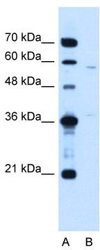 WB Suggested Anti-MGC39633 Antibody Titration: 1.25 ug/ml; Positive Control: Jurkat cell lysate