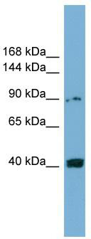WB Suggested Anti-UNC5C Antibody Titration: 0.2-1 ug/ml; Positive Control: COLO205 cell lysate