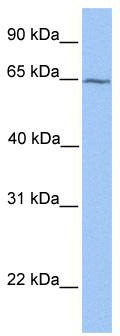 WB Suggested Anti-RXRB Antibody Titration: 0.2-1 ug/ml; Positive Control: Jurkat cell lysate. RXRB is strongly supported by BioGPS gene expression data to be expressed in Human Jurkat cells