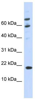 WB Suggested Anti-C21orf87 Antibody Titration: 0.2-1 ug/ml; ELISA Titer: 1: 312500; Positive Control: 293T cell lysate