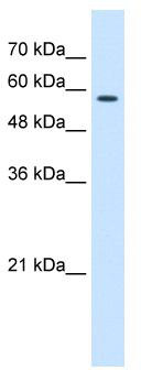 WB Suggested Anti-CCT8 Antibody Titration: 0.2-1 ug/ml; Positive Control: Jurkat cell lysate.CCT8 is strongly supported by BioGPS gene expression data to be expressed in Jurkat