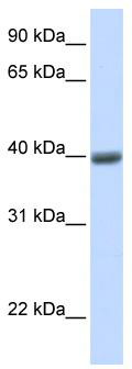 WB Suggested Anti-MAGEA1 Antibody Titration: 0.2-1 ug/ml; ELISA Titer: 1: 62500; Positive Control: Human heart