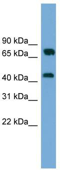 WB Suggested Anti-MAT2A Antibody Titration: 0.2-1 ug/ml; ELISA Titer: 1: 312500; Positive Control: Hela cell lysate.MAT2A is strongly supported by BioGPS gene expression data to be expressed in Human HeLa cells