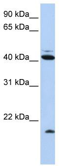 WB Suggested Anti-UBD Antibody Titration: 0.2-1 ug/ml; ELISA Titer: 1: 312500; Positive Control: HepG2 cell lysate.UBD is supported by BioGPS gene expression data to be expressed in HepG2
