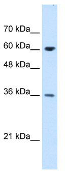 WB Suggested Anti-STIP1 Antibody Titration: 1.25 ug/ml; Positive Control: Jurkat cell lysate.STIP1 is strongly supported by BioGPS gene expression data to be expressed in Human Jurkat cells