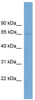 WB Suggested Anti-IL1RL2 Antibody Titration: 0.2-1 ug/ml; ELISA Titer: 1: 1562500; Positive Control: Hela cell lysate