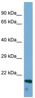 Host: Rabbit; Target Name: ECM1; Sample Tissue: HepG2 Whole cell lysates; Antibody Dilution: 1.0 ug/ml