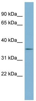 WB Suggested Anti-EFNB1 Antibody Titration: 0.2-1 ug/ml; Positive Control: Human kidney