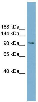 WB Suggested Anti-NCAM2 Antibody Titration: 0.2-1 ug/ml; Positive Control: ACHN cell lysate