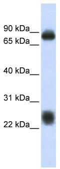 WB Suggested Anti-TSPAN8 Antibody Titration: 0.2-1 ug/ml; ELISA Titer: 1: 62500; Positive Control: Human brain
