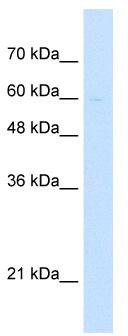 WB Suggested Anti-LETM1 Antibody Titration: 5.0 ug/ml; Positive Control: Jurkat cell lysate.LETM1 is strongly supported by BioGPS gene expression data to be expressed in Human Jurkat cells