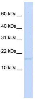 WB Suggested Anti-C3orf18 Antibody Titration: 0.2-1 ug/ml; ELISA Titer: 1: 12500; Positive Control: 721_B cell lysate