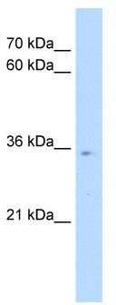WB Suggested Anti-POU6F1 Antibody Titration: 0.2-1 ug/ml; Positive Control: HepG2 cell lysate.There is BioGPS gene expression data showing that POU6F1 is expressed in HepG2