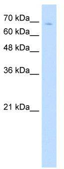 WB Suggested Anti-TCF25 Antibody Titration: 5.0 ug/ml; Positive Control: Jurkat cell lysate