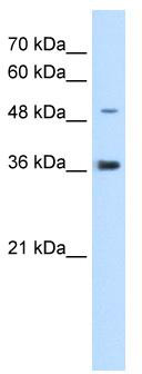 WB Suggested Anti-IRX1 Antibody Titration: 5.0 ug/ml; Positive Control: HepG2 cell lysate