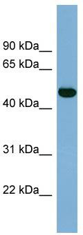 WB Suggested Anti-IRX1 Antibody Titration: 0.2-1 ug/ml; ELISA Titer: 1: 12500; Positive Control: Human Small Intestine