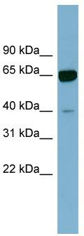 WB Suggested Anti-ZNF169 Antibody Titration: 0.2-1 ug/ml; Positive Control: Human kidney
