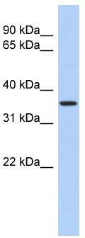 WB Suggested Anti-POLR3F Antibody Titration: 0.2-1 ug/ml; ELISA Titer: 1: 62500; Positive Control: PANC1 cell lysate