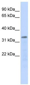 WB Suggested Anti-POLR3F Antibody Titration: 0.2-1 ug/ml; ELISA Titer: 1: 62500; Positive Control: 721_B cell lysate.POLR3F is supported by BioGPS gene expression data to be expressed in 721_B