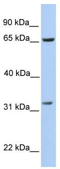 WB Suggested Anti-PBK Antibody Titration: 0.2-1 ug/ml; Positive Control: 721_B cell lysate. PBK is supported by BioGPS gene expression data to be expressed in 721_B