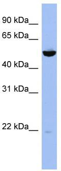 WB Suggested Anti-MAP2K7 Antibody Titration: 0.2-1 ug/ml; ELISA Titer: 1:62500; Positive Control: Jurkat cell lysate