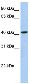 WB Suggested Anti-FAM105A Antibody Titration: 0.2-1 ug/ml; Positive Control: 721_B cell lysate; FAM105A is supported by BioGPS gene expression data to be expressed in 721_B