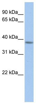 WB Suggested Anti-MFF Antibody Titration: 0.2-1 ug/ml; Positive Control: Human Muscle