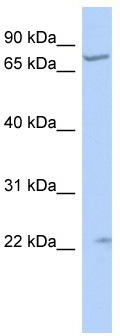 WB Suggested Anti-STRA6 Antibody Titration: 0.2-1 ug/ml; ELISA Titer: 1: 62500; Positive Control: HepG2 cell lysate