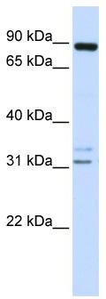 WB Suggested Anti-ADAM19 Antibody Titration: 0.2-1 ug/ml; ELISA Titer: 1: 62500; Positive Control: 721_B cell lysate ADAM19 is supported by BioGPS gene expression data to be expressed in 721_B