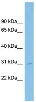 WB Suggested Anti-SPATA9 Antibody Titration: 0.2-1 ug/ml; ELISA Titer: 1: 12500; Positive Control: U937 cell lysate