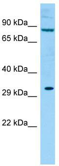 WB Suggested Anti-Kirrel2 Antibody; Titration: 1.0 ug/ml; Positive Control: Rat Testis