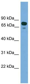 WB Suggested Anti-ZNF599 Antibody Titration: 0.2-1 ug/ml; ELISA Titer: 1: 62500; Positive Control: 293T cell lysate