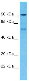 Host: Rabbit; Target Name: ZNF658B; Sample Tissue: Breast Tumor lysates; Antibody Dilution: 1.0 ug/ml