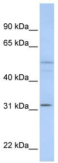 WB Suggested Anti-ZFYVE19 Antibody Titration: 0.2-1 ug/ml; ELISA Titer: 1: 1562500; Positive Control: MCF7 cell lysate