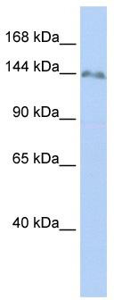 WB Suggested Anti-ZNF862 Antibody Titration: 0.2-1 ug/ml; Positive Control: 721_B cell lysate