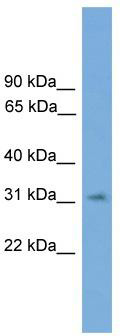 WB Suggested Anti-SPRY3 Antibody Titration: 0.2-1 ug/ml; Positive Control: 721_B cell lysate