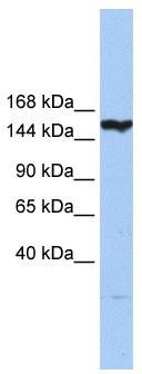 WB Suggested Anti-CASP8AP2 Antibody Titration: 0.2-1 ug/ml; Positive Control: Hela cell lysate