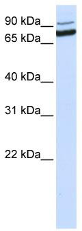 WB Suggested Anti-XAB2 Antibody Titration: 0.2-1 ug/ml; ELISA Titer: 1: 62500; Positive Control: MCF7 cell lysate