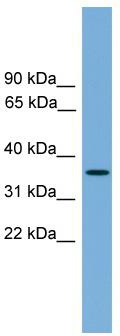 WB Suggested Anti-SPRY4 Antibody Titration: 0.2-1 ug/ml; ELISA Titer: 1: 1562500; Positive Control: Hela cell lysate