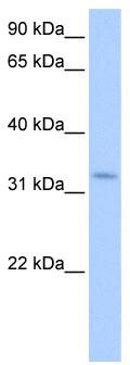 WB Suggested Anti-NRIP2 Antibody Titration: 0.2-1 ug/ml; Positive Control: Human brain