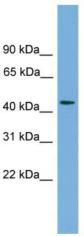 WB Suggested Anti-ZNF620 Antibody Titration: 0.2-1 ug/ml; ELISA Titer: 1: 312500; Positive Control: THP-1 cell lysate