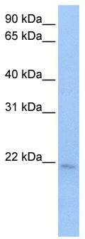 WB Suggested Anti-SPATA12 Antibody Titration: 0.2-1 ug/ml; Positive Control: Jurkat cell lysate