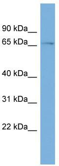 WB Suggested Anti-ZNF697 Antibody Titration: 0.2-1 ug/ml; ELISA Titer: 1: 62500; Positive Control: ACHN cell lysate