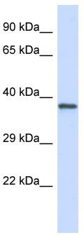Host: Rabbit; Target Name: GP1BA; Sample Tissue: Jurkat Whole Cell lysates; Antibody Dilution: 1.0 ug/ml