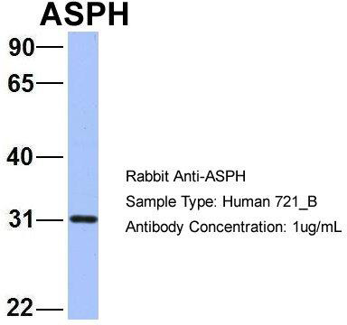 Aspartate beta hydroxylase (ASPH) Rabbit Polyclonal Antibody - image 1