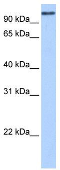 WB Suggested Anti-MICALL1 Antibody Titration: 0.2-1 ug/ml; Positive Control: Human Liver
