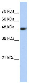 WB Suggested Anti-CPN1 Antibody Titration: 0.2-1 ug/ml; ELISA Titer: 1: 62500; Positive Control: Transfected 293T