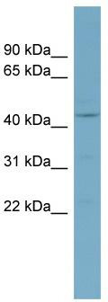 WB Suggested Anti-CSNK1D Antibody Titration: 0.2-1 ug/ml; ELISA Titer: 1: 12500; Positive Control: OVCAR-3 cell lysate