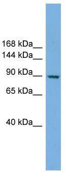 WB Suggested Anti-RAPGEF3 Antibody Titration: 0.2-1 ug/ml; ELISA Titer: 1: 1562500; Positive Control: COLO205 cell lysate