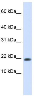 WB Suggested Anti-GABARAPL2 Antibody Titration: 0.2-1 ug/ml; ELISA Titer: 1: 62500; Positive Control: 293T cell lysateGABARAPL2 is supported by BioGPS gene expression data to be expressed in HEK293T